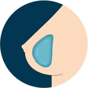 JY  Breast Option - Gel Breasts